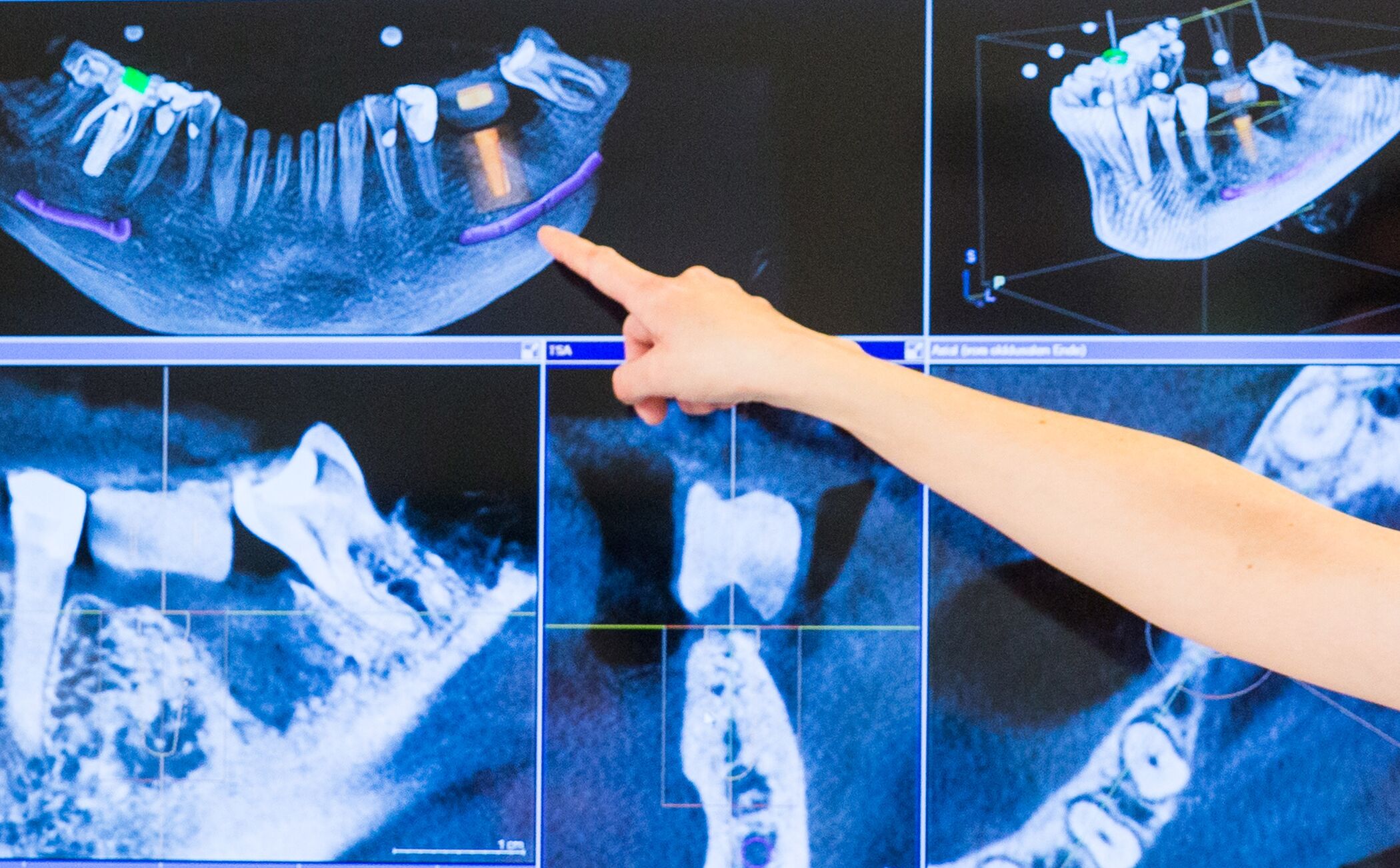 3D-Röntgen - Zahnmedizin Merzenich - Düren